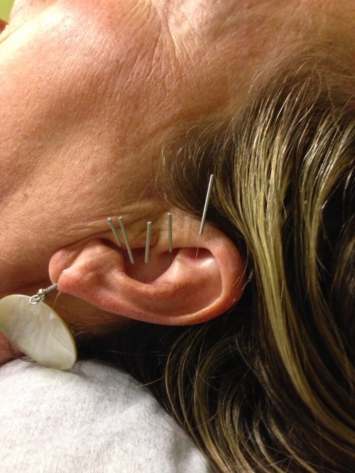 yes, that is my ear. pretty cOOl, huh?!